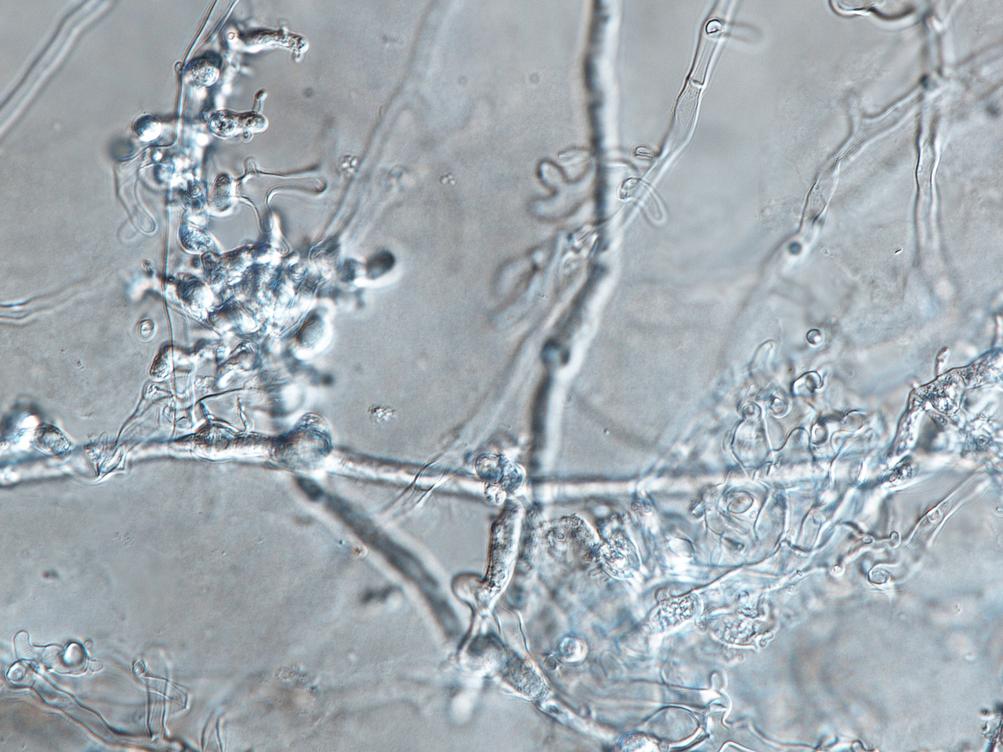   Phytophthora quercetorum  (ex-type CPHST BL 52G) asexual phase: coralloid mycelia; photo by Gloria Abad, USDA-APHIS-PPQ. 
